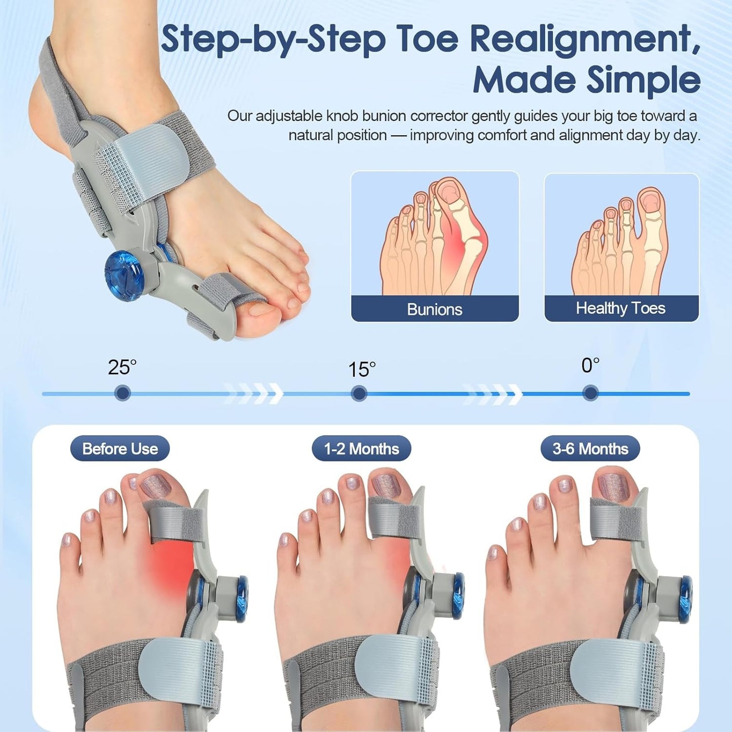 Feeti Fix Bunion Corrector